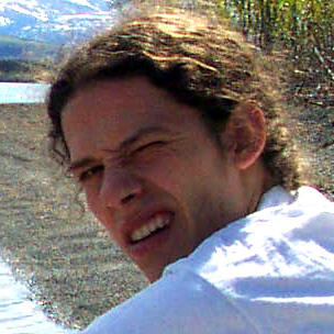 Photo of Aaron's head.