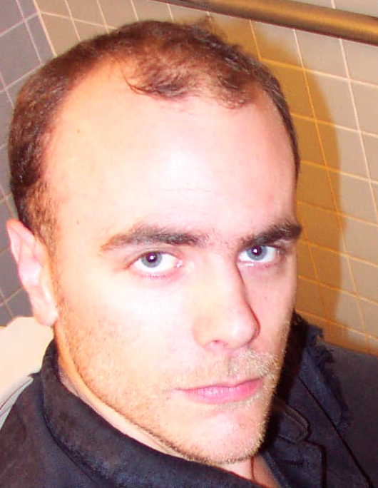 Photo of Alex's head.