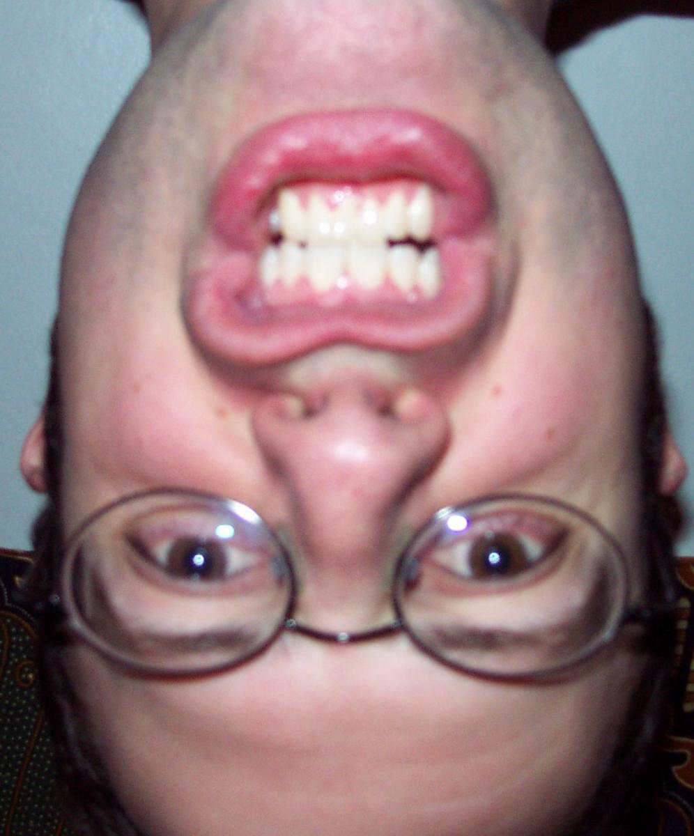 Photo of Julian's head.