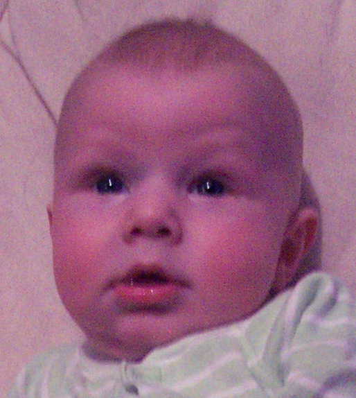 Photo of Stan's head.