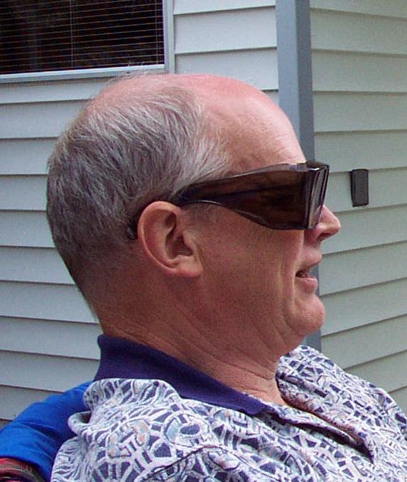 Photo of Syd's head.