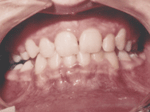 Patient photo after treatment