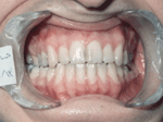Patient photo after treatment