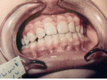 Patient photo after treatment
