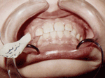 Patient photo after treatment