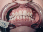 Patient photo after treatment