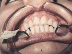 Patient photo after treatment