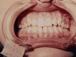 Patient photo after treatment