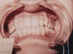 Patient photo after treatment