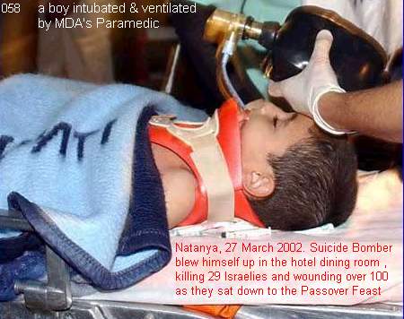 Suicide Bomber on Passover Feast , Natanya