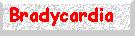 Bradycardia Algorhithm