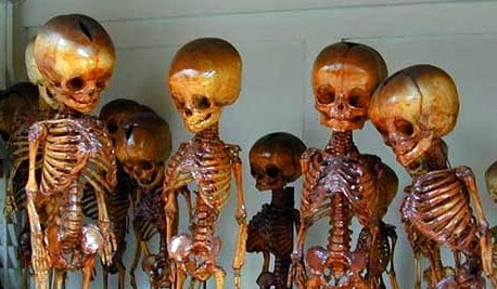 Pygmy Skeletons