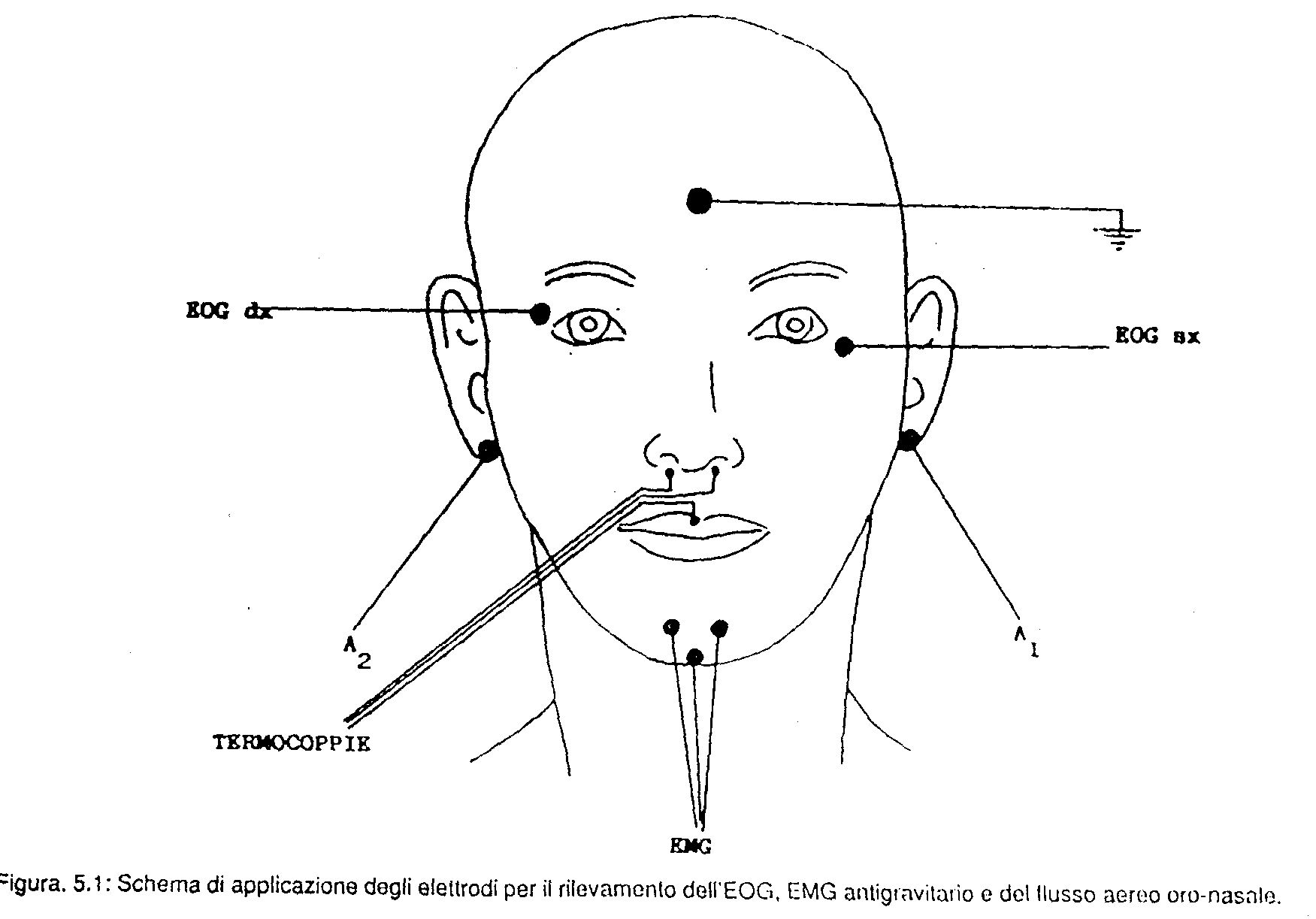 Schema montaggio emg