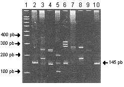 Single Strand Conformation Polymorphism