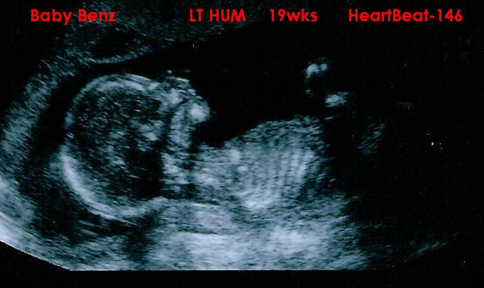 Look at our Baby