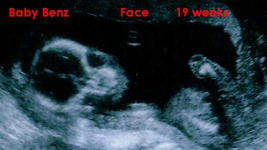 Looks like an alien :D