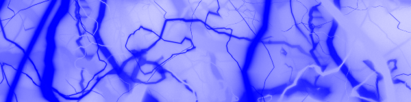 Blue Lightning