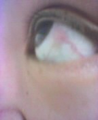 ouch!