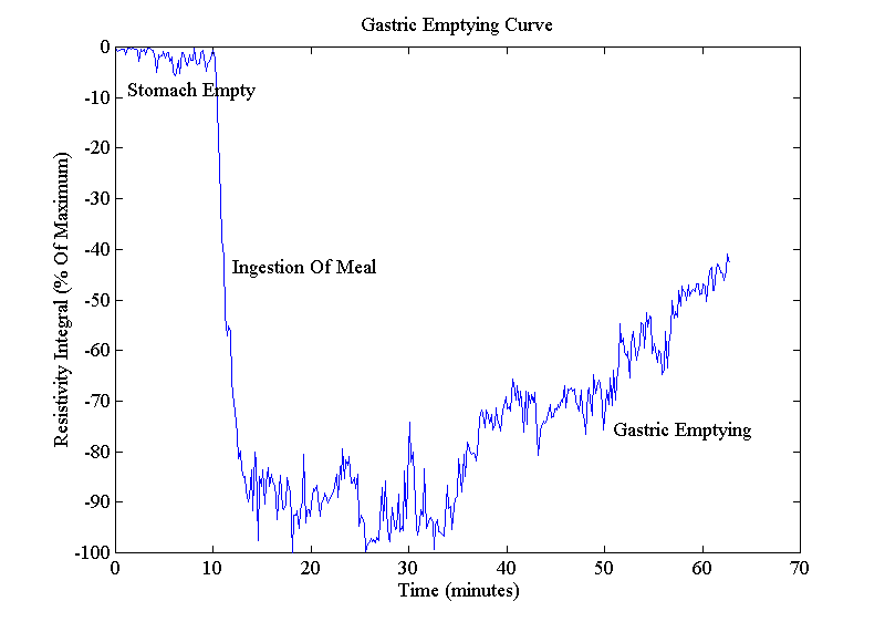 GE curve