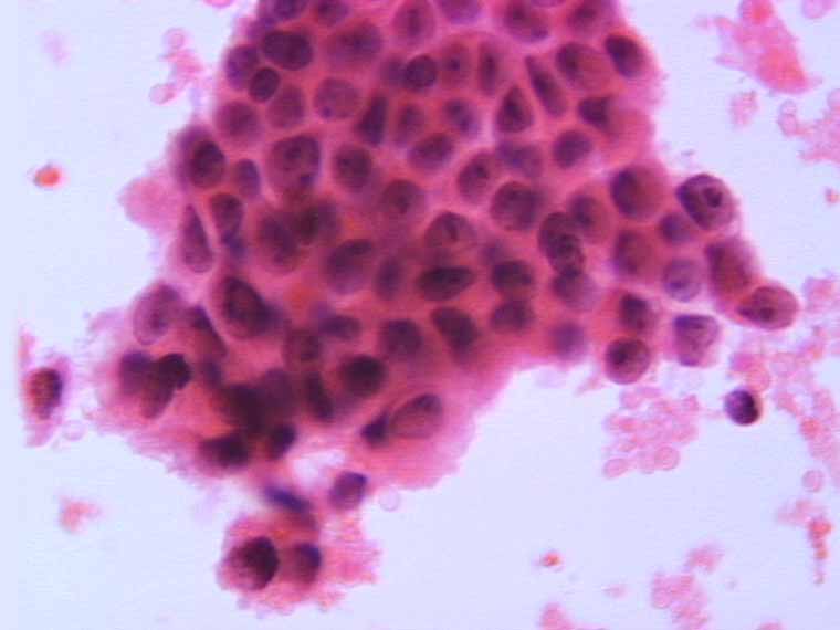 A prepared smear