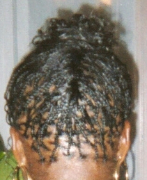Zig-Zag Corn-row Back View.