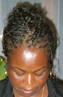 Zig-Zag Corn-row Front View.