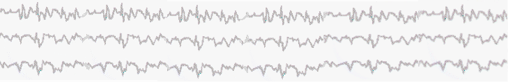 brainwave background