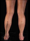 natural but slightly knock-kneed