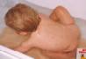 Chicken Pox! (back)