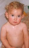 Chicken Pox! (front)
