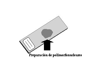 Preparaci�n de neutr�filos