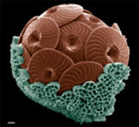 diatom[1].jpg (7033 bytes)
