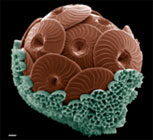 diatom[1].jpg (7033 bytes)