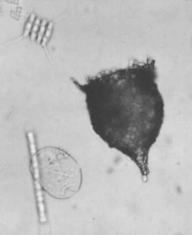 micro[1].jpeg (12406 bytes)