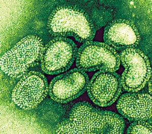 H1N1 (Swine) Flu virus