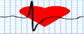 BMI WHR health watch