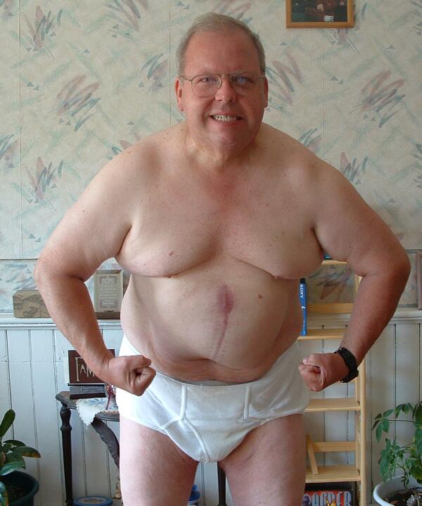Chuck 7 months post-op 

(hernia)