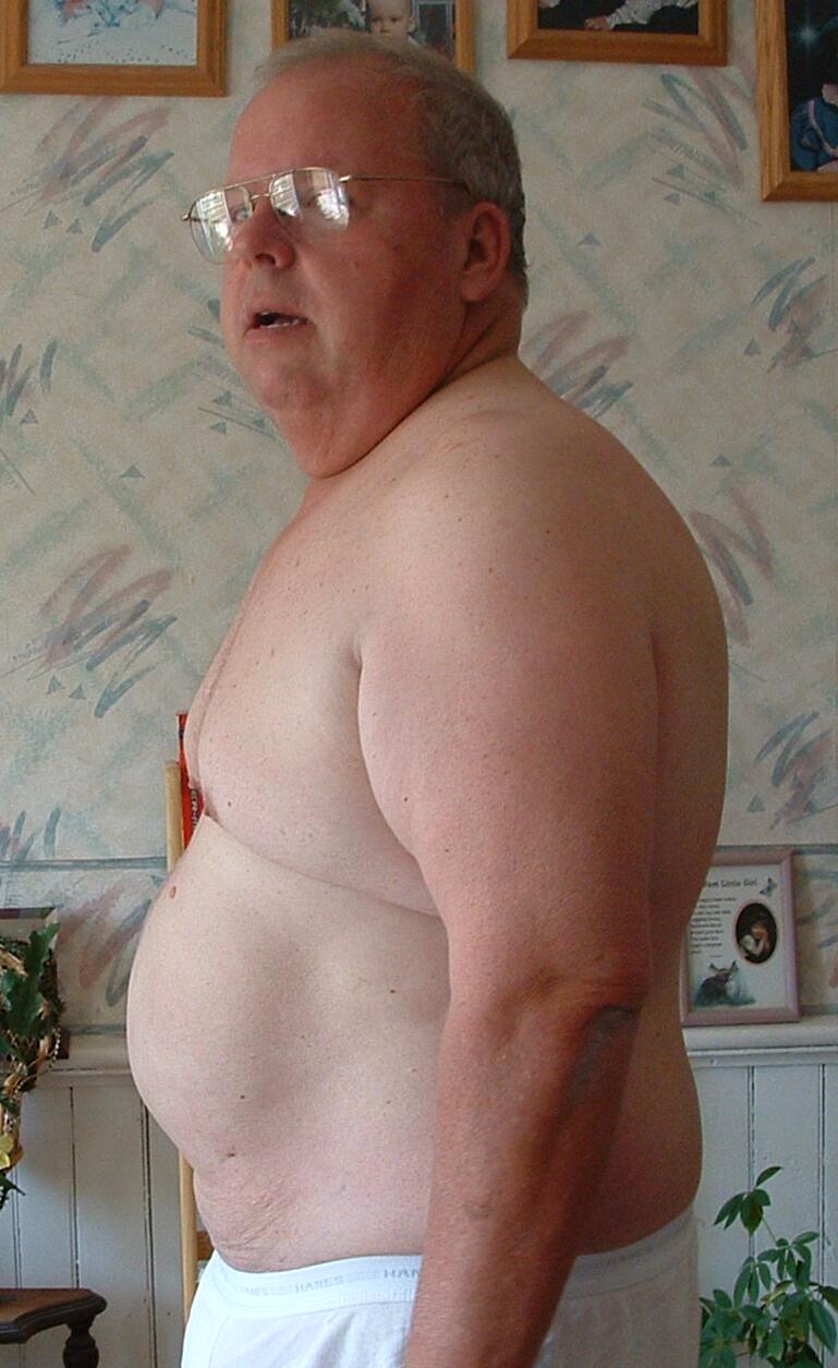 June 19, 2003 (Hernia)
