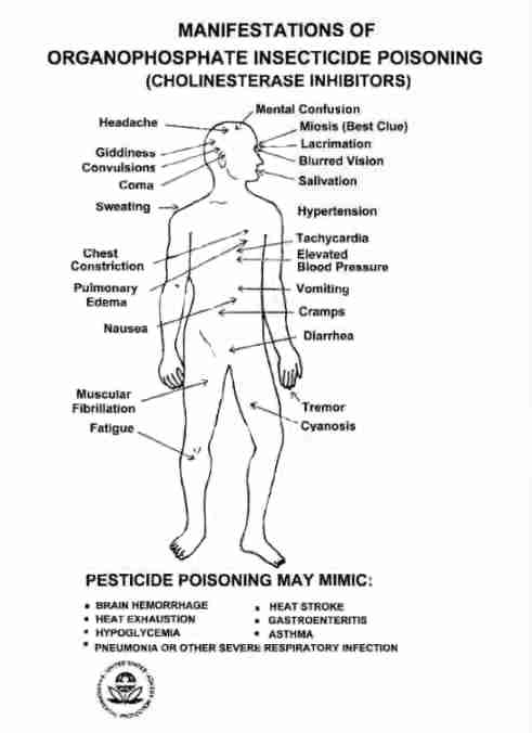 Diagram of symptoms and the illnesses poisons can mimic