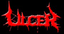 Ulcer