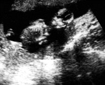 full baby