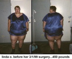 LindaBefore.jpg