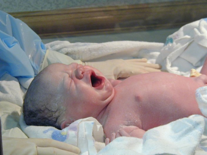 Alexis right after she was born