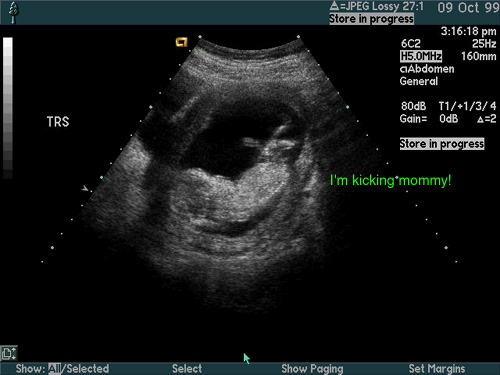 /user/u_s_kick.jpg