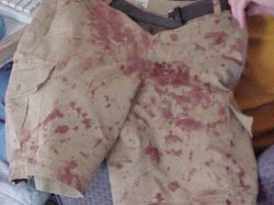 QTBoy's bloody shorts.