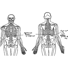 Position der Schu�verletzung