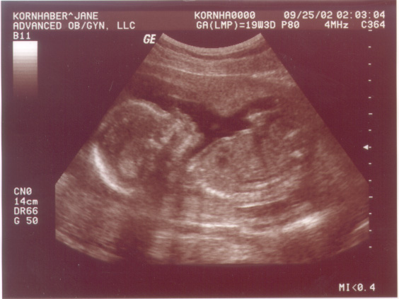 teeny girl!