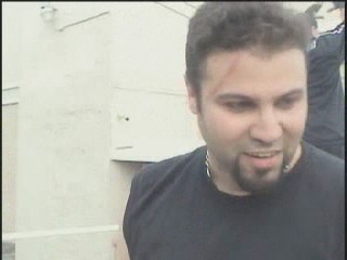 Injury from Contract Brawl