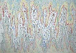 Vision, by Chiricut� M�d�lin