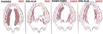 glossograma